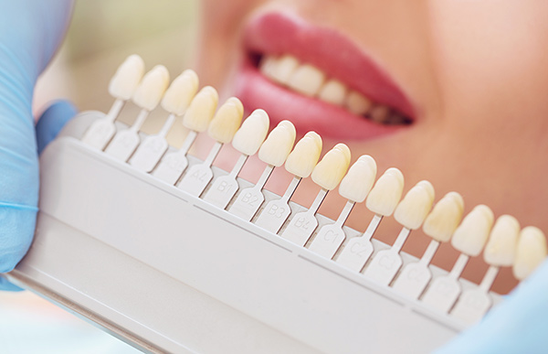 Dental Implant color selection at Facial and Oral Surgery Institute