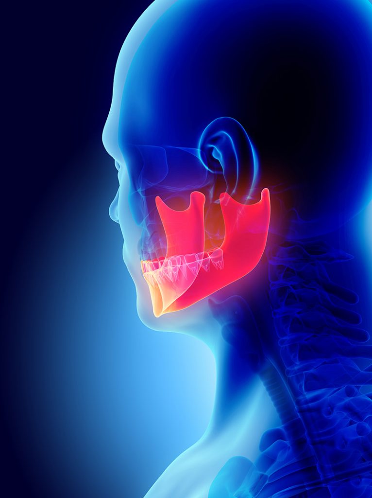 Side view of TMJ Disorder - Illustration
