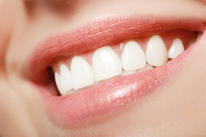 Get the perfect smile at FOSI