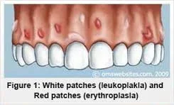 oral-pathology